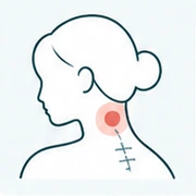 목 뒤쪽의 불편한 부위를 표시한 일러스트