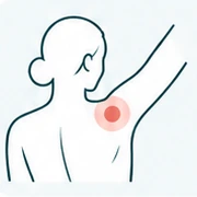 팔을 올린 자세와 어깨의 불편한 부위를 표시한 일러스트